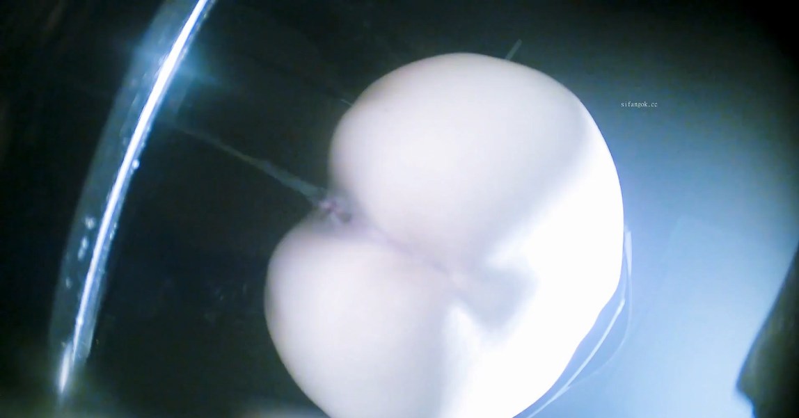 Chinese Girl Big Ass Squatting Pee Hidden Cam
